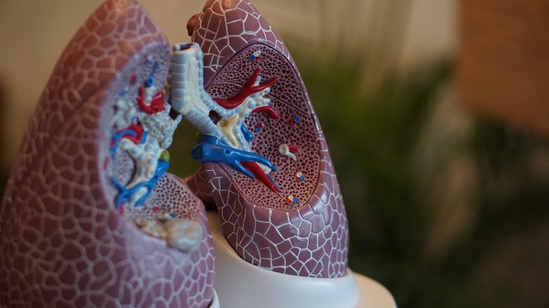 Frukwintynib w leczeniu raka płuca: Czy już tam jesteśmy?