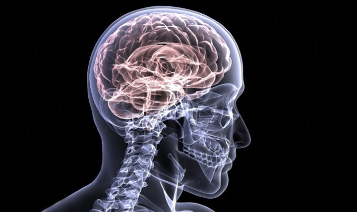 X-ray ludzkiego mózgu 